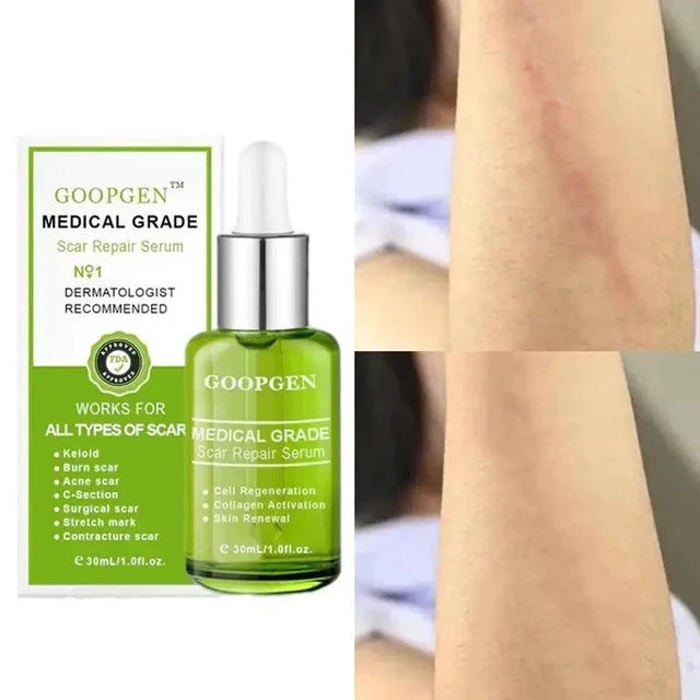 Goopgen Anti-Scar Serum