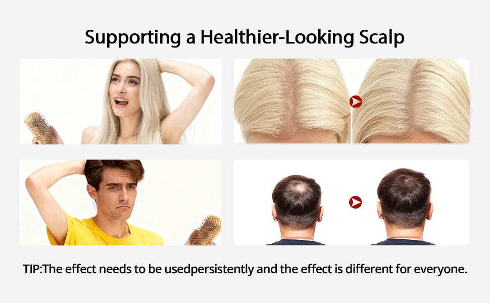 Advanced Red Light Hair Growth & Scalp Therapy Cap