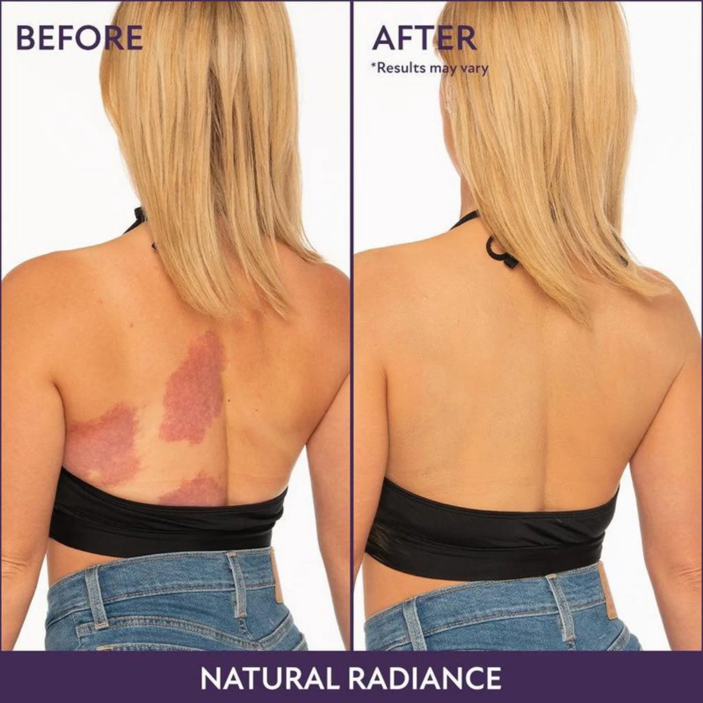 Epixen™ Flawless Body Coverage + Free Brush