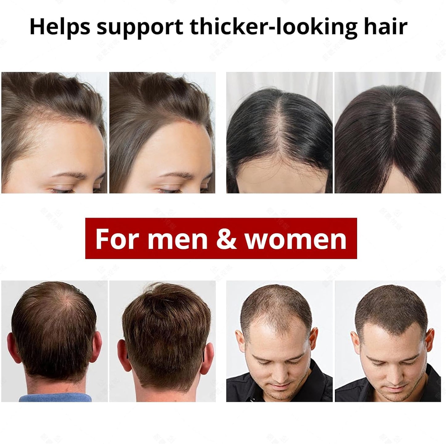 Advanced Red Light Hair Growth & Scalp Therapy Cap