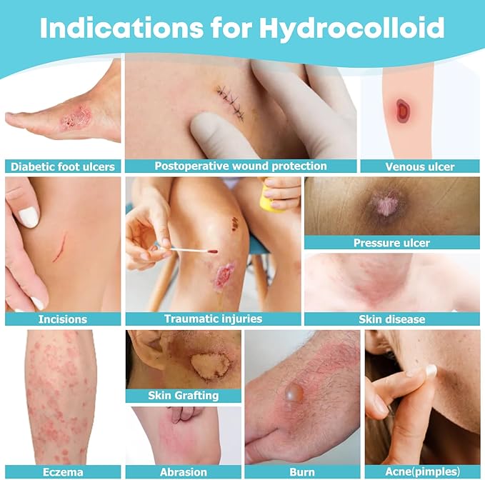 Medical Grade Hydrocolloid Roll