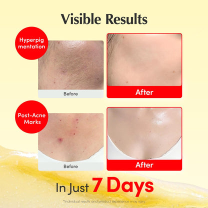 EQQUALBERRY Vitamin C Brightening Cream