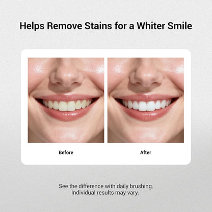 MSDRWIKEY Deep Smile Whitening Toothpaste