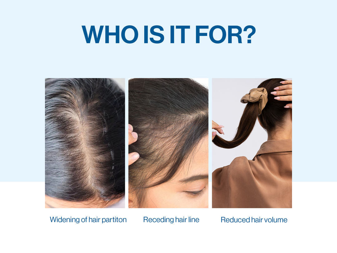 Epixen Advanced Hair Roll-On