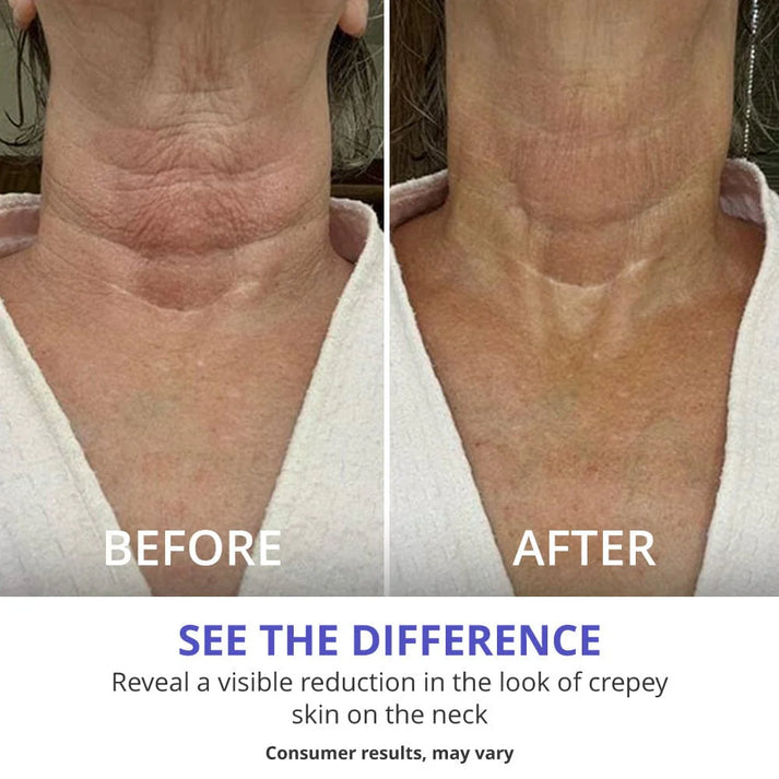 Neck Lift Cream