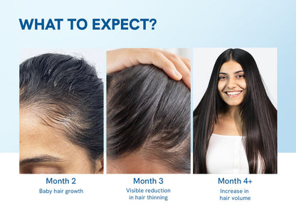 Epixen Advanced Hair Roll-On