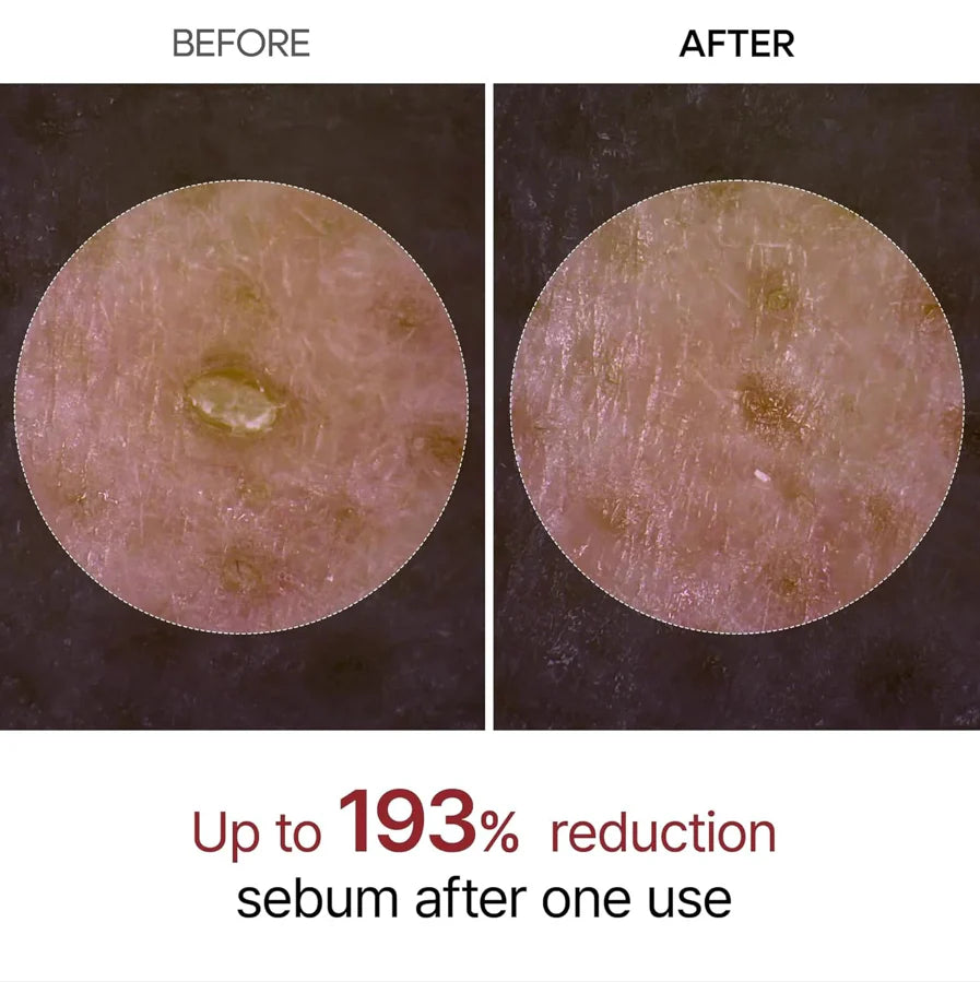 SilkGlow Rice Ampoule Exfoliant Set